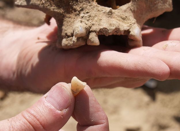 Shovel Shaped Incisor. Photo by Dave Vlcek.